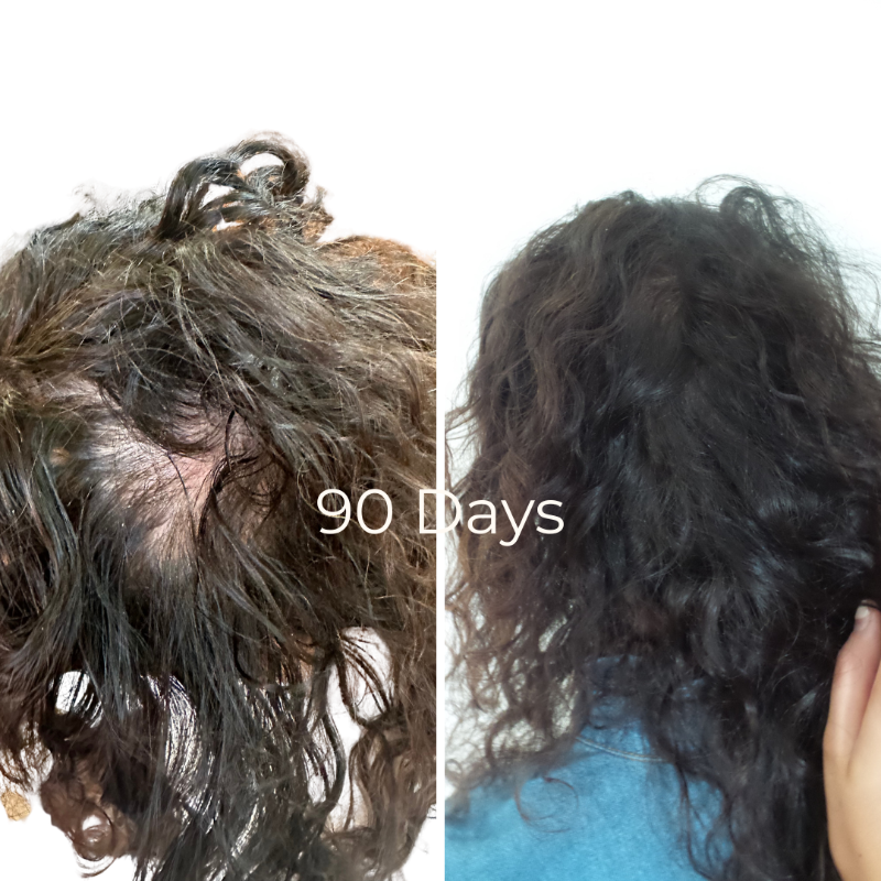 Restore Scalp Elixir 30ml
